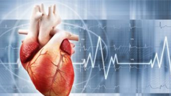 curso de electrocardiograma Avanzada