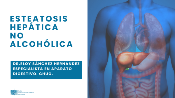 Esteatosis hepática no alcoholica